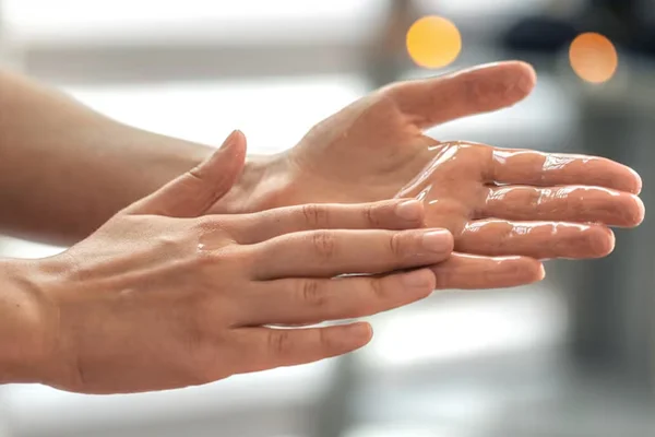 Hyperhidrosis